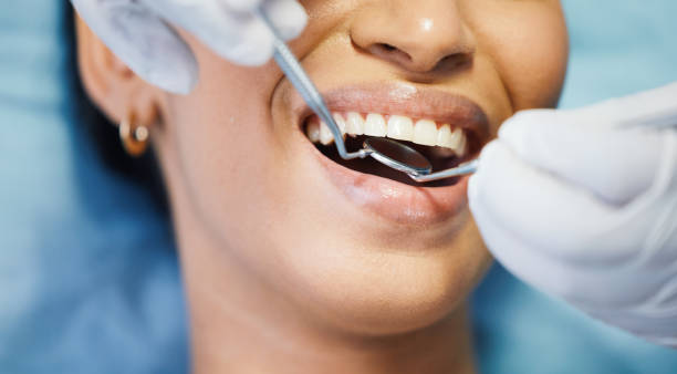 Best Urgent Care for Lost Fillings or Crowns in Duryea, PA